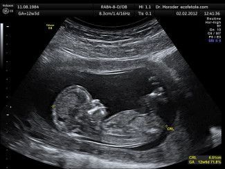 Hailey Bieber anuncia su embarazo