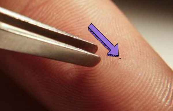 Nueva forma de implantar nanochips