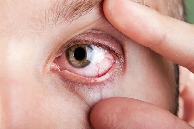 ¿Sabias que la paja te causa problemas en la vista?