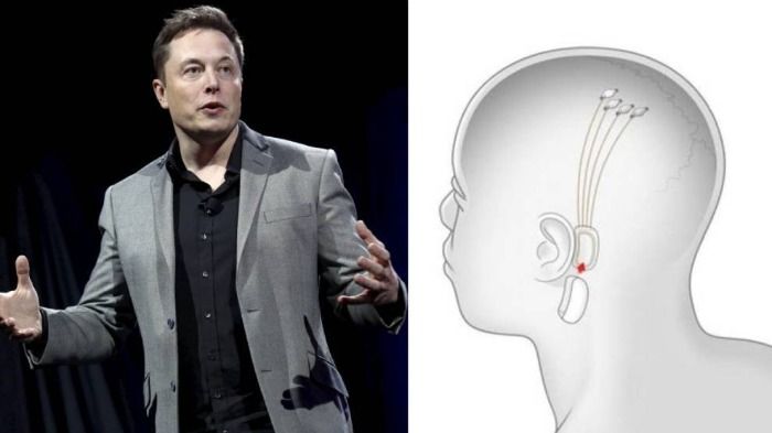 ¿Hackeo fácil? Los implantes de Elon Musk no tienen buena defensa