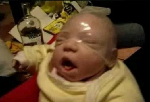 Bebé con condón en la cabeza influye fuertemente en la reactivación económica