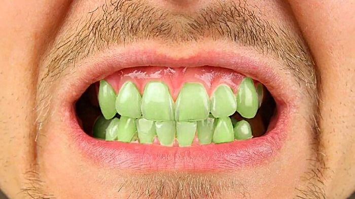 El Nestea provoca un enverdecimiento de los dientes.