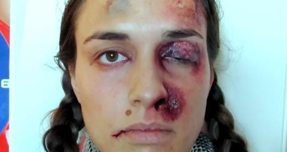 Mujer de 32 años golpea brutalmente a su novia porque no le contestó el teléfono